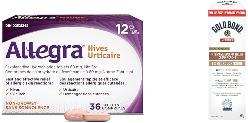 Allegra Hives, 12-Hour Itchy Skin Relief Due to Hives, Allergic Skin Reactions + Gold Bond Medicated Intensive Eczema Relief 1% Hydrocortisone Cream