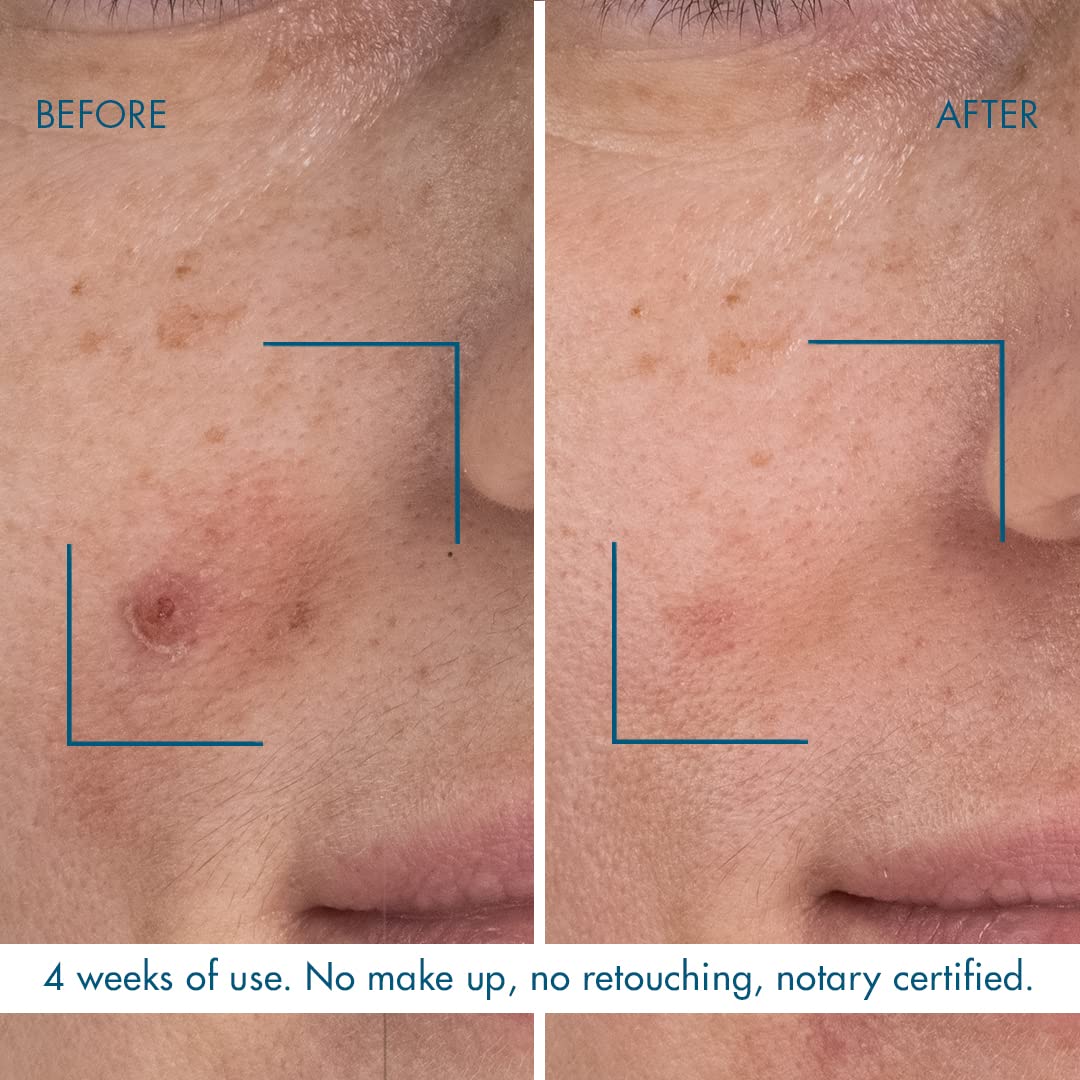 碧欧泉视黄醇面部精华液 0.25%,蓝色视黄醇焕肤晚间精华液,含透明质酸和烟酰胺,适合中性至油性肌肤的护肤品,100% 纯素,30ml