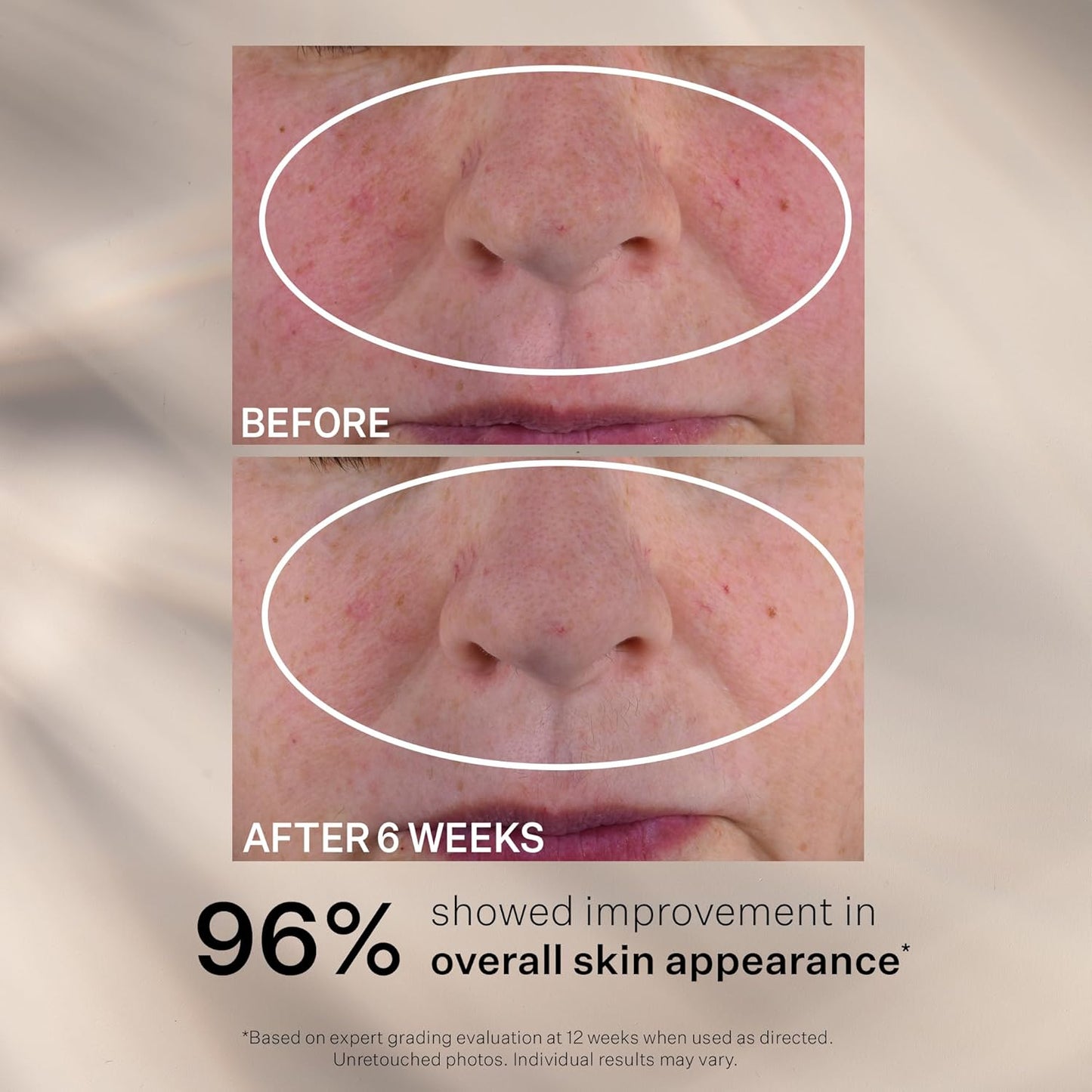 StriVectin Advanced Retinol Nightly Multi-Correct Face Serum