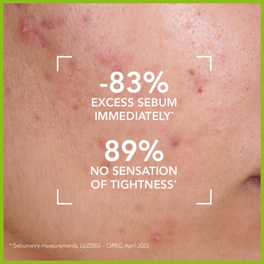 Bioderma 贝德玛 Sébium 泡沫啫喱温和洁面乳,卸妆洁面乳,净化洁面乳,适合混合性至油性皮肤,16.7 液体盎司