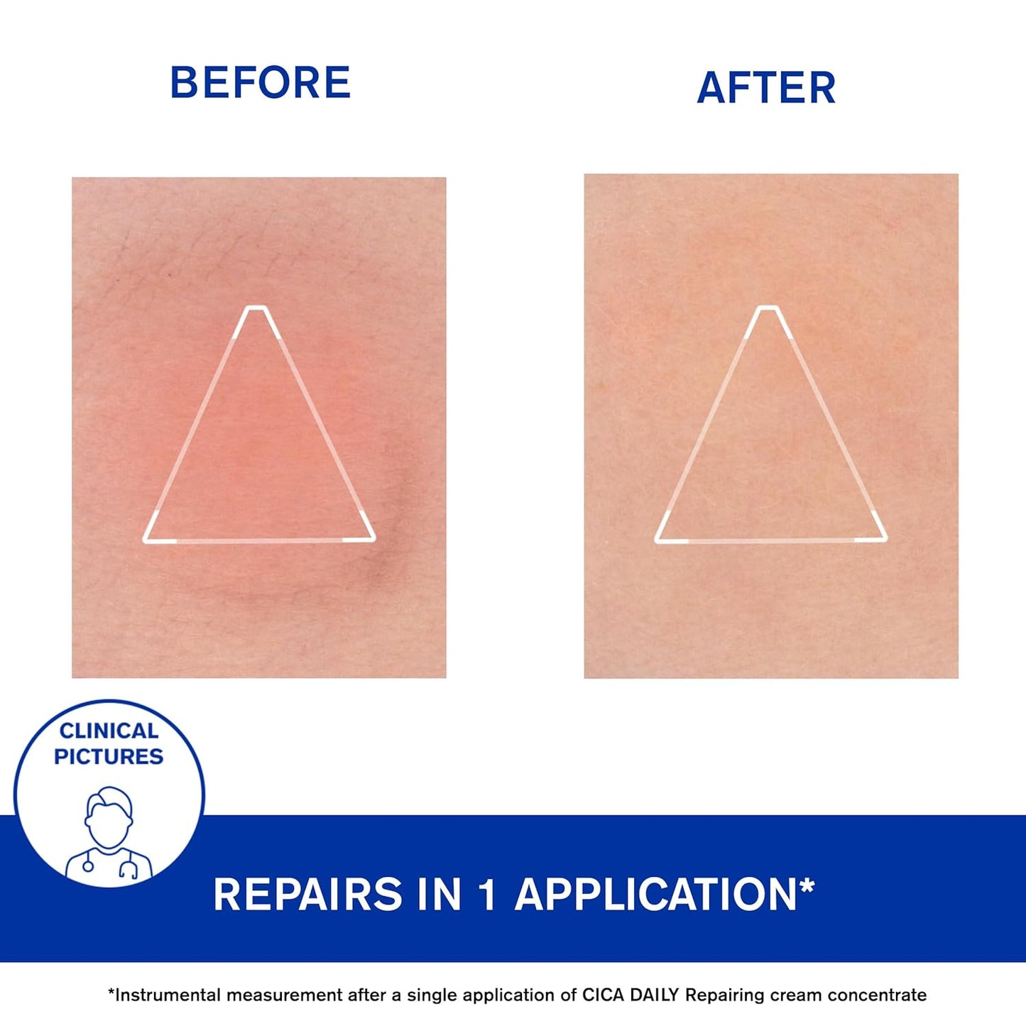 Uriage CICA Daily Gel-Cream - Lightweight Face Cream With Hyaluronic Acid, Vitamin B5 & Copper-Zinc - Fagrance-Free & Non-Sticky - 40ml