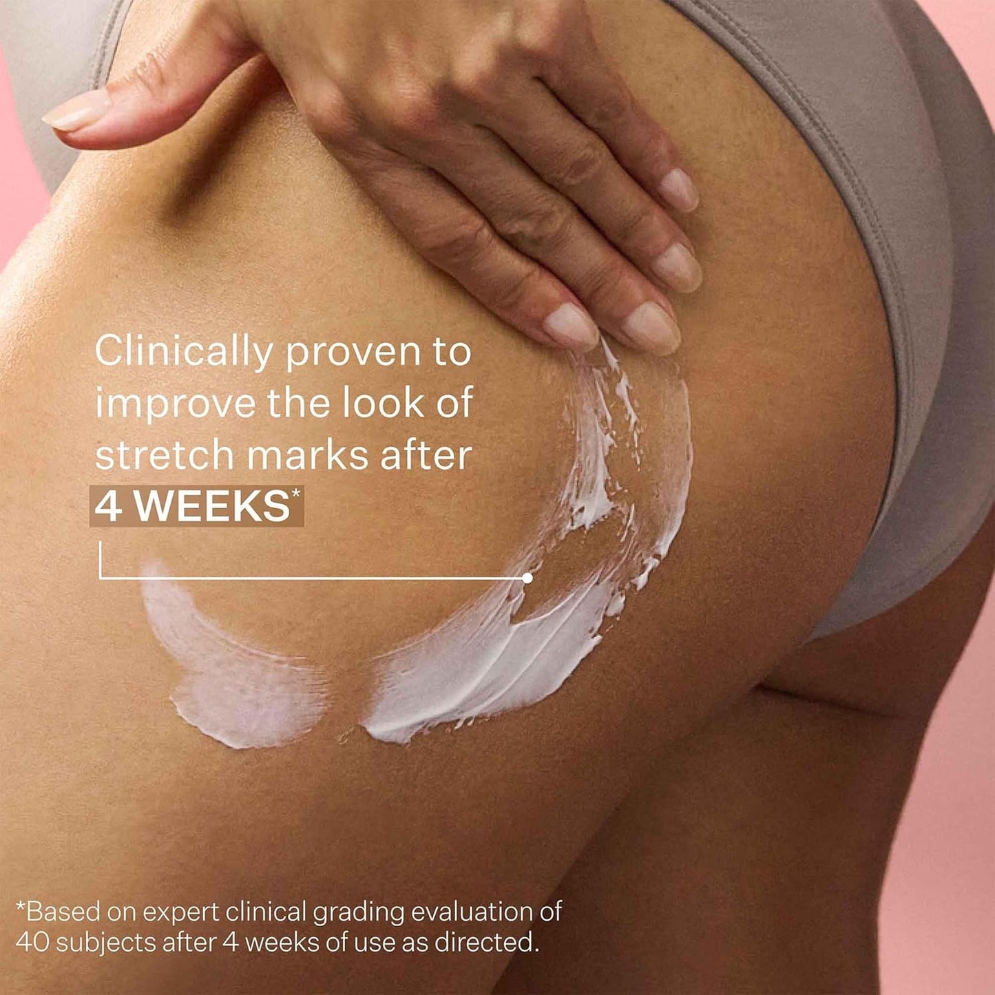 StriVectin SD Advanced™ Plus 強效保濕霜,針對皺紋和妊娠紋,適用於臉部和身體,促進膠原蛋白生成,含勝肽和透明質酸,4 液盎司(1 包)