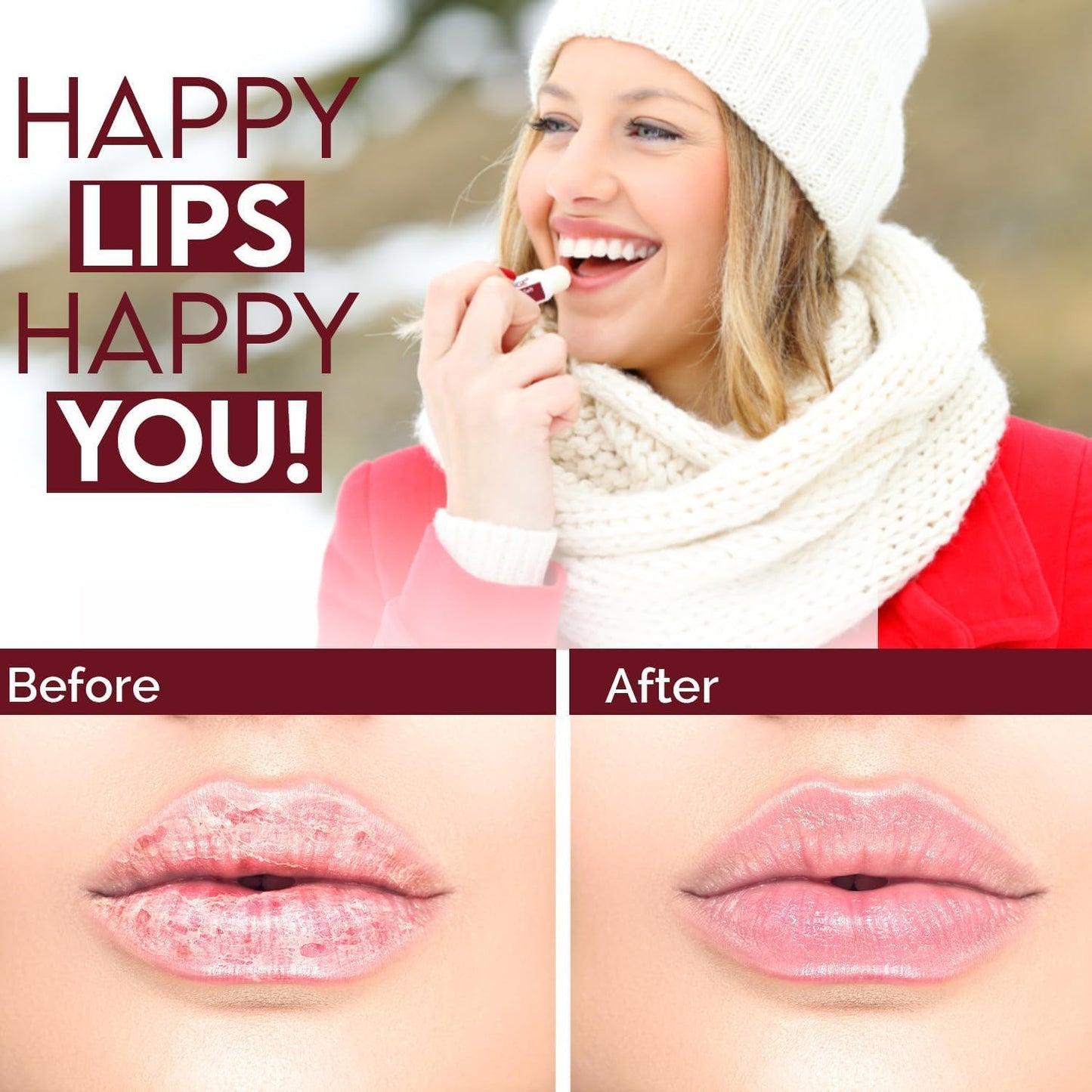 天然解決方案潤唇膏,蘊含櫻桃和有機乳木果油,保濕唇部護理多包裝,乾燥嘴唇的保濕霜,有機潤唇膏 - 3 支裝,6 件