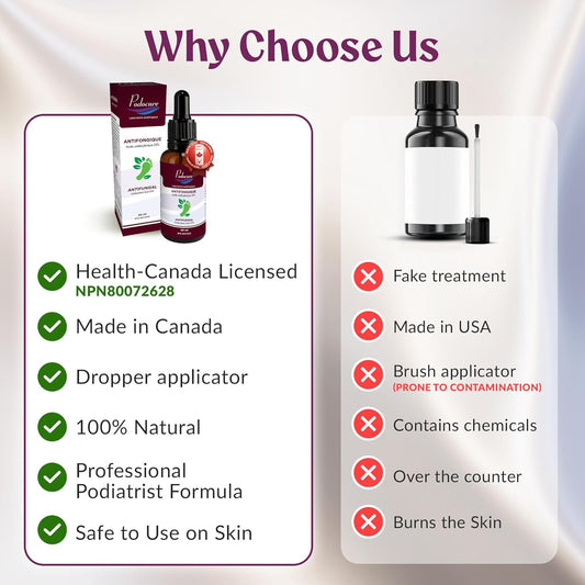 PODOCURE Toenail Fungus Treatment – Extra-Strength Antifungal Liquid 30ml with 25% Undecylenic Acid – Natural Remedy for Athlete’s Foot, Discoloration, Peeling, Mycosis, Redness, Itch, Odor – Made in Canada