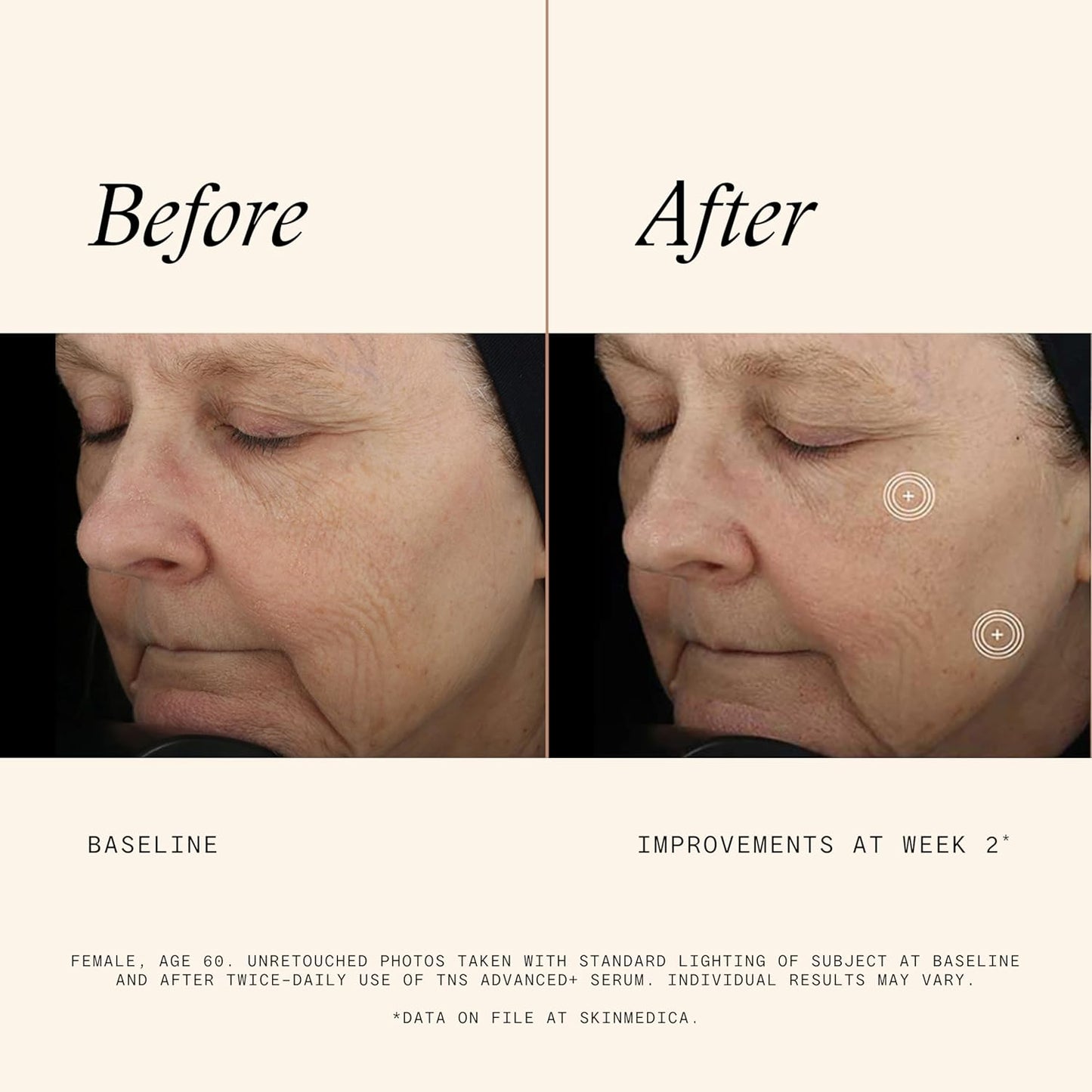 Skinmedica Tns Advanced+ 精華液,1.0 盎司