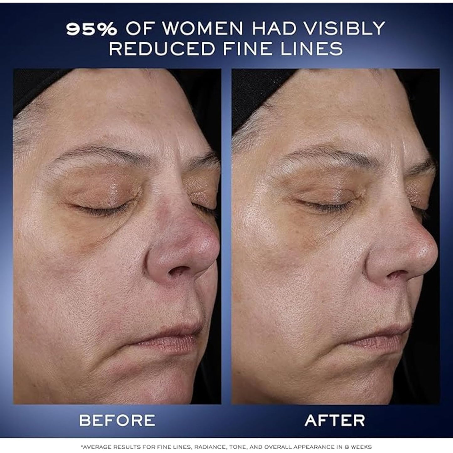 Lancôme Génifique Ultimate Dual Recovery Face Serum- Anti-Aging Serum Visibly Improves Fine Lines, Rough Texture, Plumpness and Even Skintone - with Beta Glucan and, Hyaluronic Acid