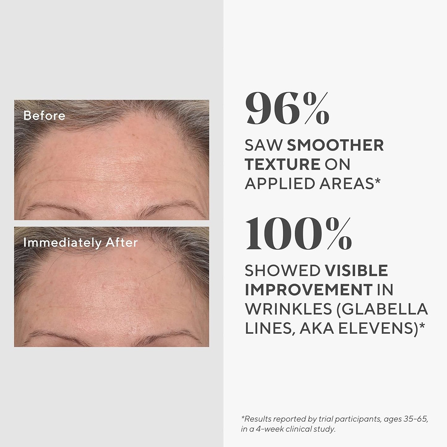 Murad Targeted Wrinkle Corrector - Resurgence Anti-Wrinkle Face Cream - Instant Filler Wrinkle Corrector - Gentle Anti-Aging Hydrating Hyaluronic Acid Treatment Backed by Science, 15ml