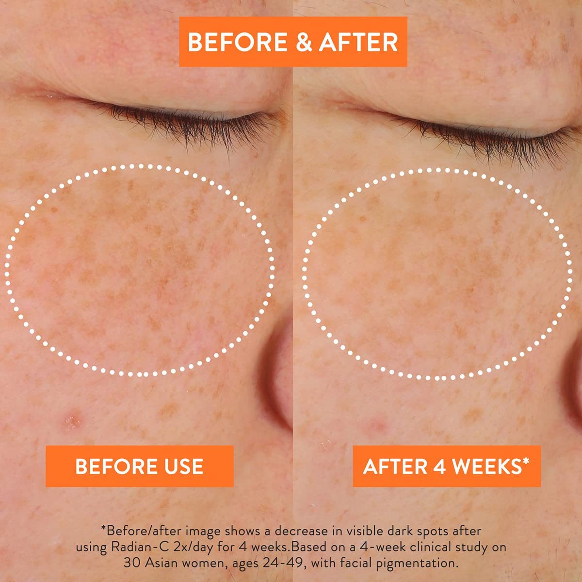 LANEIGE Radian-C Cream: Brightening Moisturizer with Vitamin C & E for Dark Spots, Dullness, & Radiant Skin, Hypoallergenic & Dermatologist-Tested