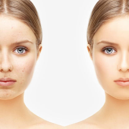 Sewanti 有机印度楝树健康护肤 Npn 80065670 60克