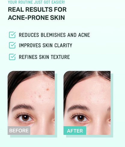 Bring 绿茶树积雪草舒缓霜 男女通用-3.38 盎司