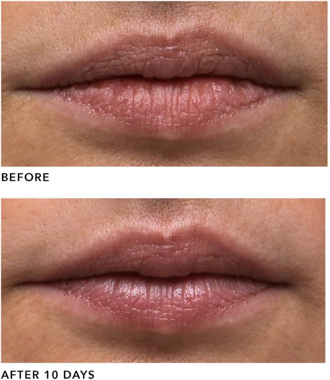 Algenist 女士 Genius 液體膠原蛋白唇膏 - 0.5 盎司