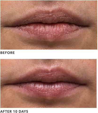 Algenist 女士 Genius 液體膠原蛋白唇膏 - 0.5 盎司