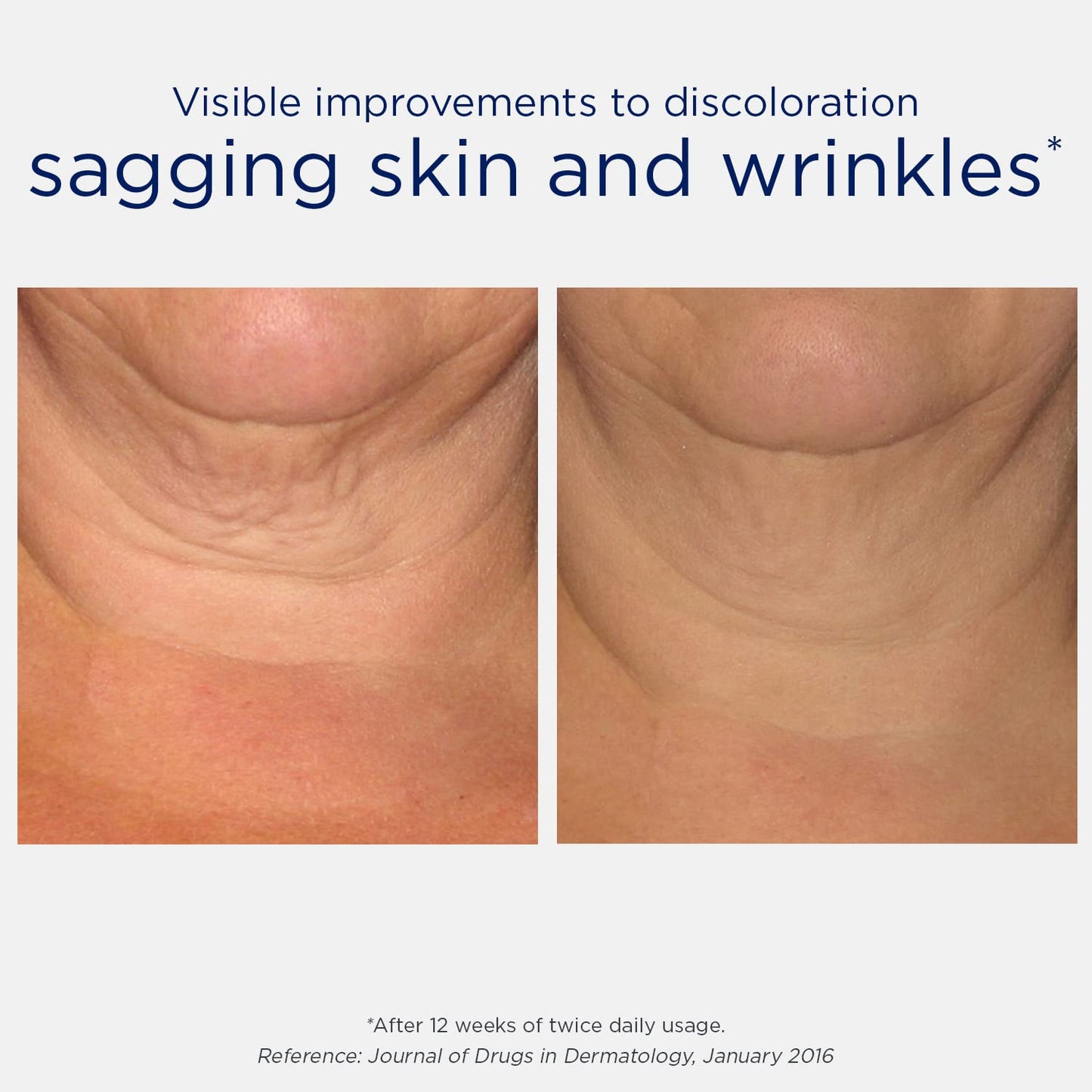 Neostrata Skin Active