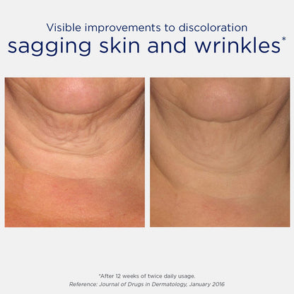 Neostrata Skin Active