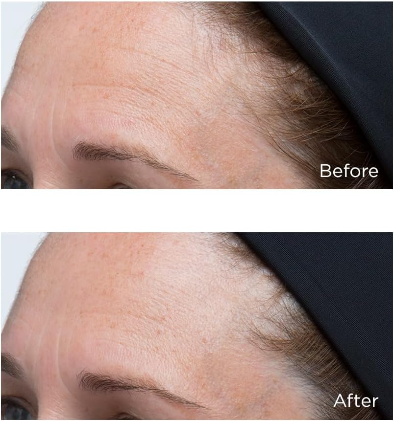 Perricone MD Perricone: High Potencyclassics Hyaluronic Intensive Moisturizer 1 Fl Oz/ 30 Ml, 1 ounces