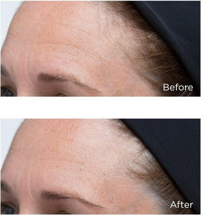 Perricone MD Perricone: High Potencyclassics Hyaluronic Intensive Moisturizer 1 Fl Oz/ 30 Ml, 1 ounces