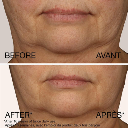 Neutrogena Rapid Firming Peptide Contour Lift Cream - Anti Aging Facial Contour Cream for Firmer looking Skin - 50 grams