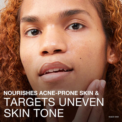 Neutrogena Ultra Gentle Face Gel Hydrator FF 141g