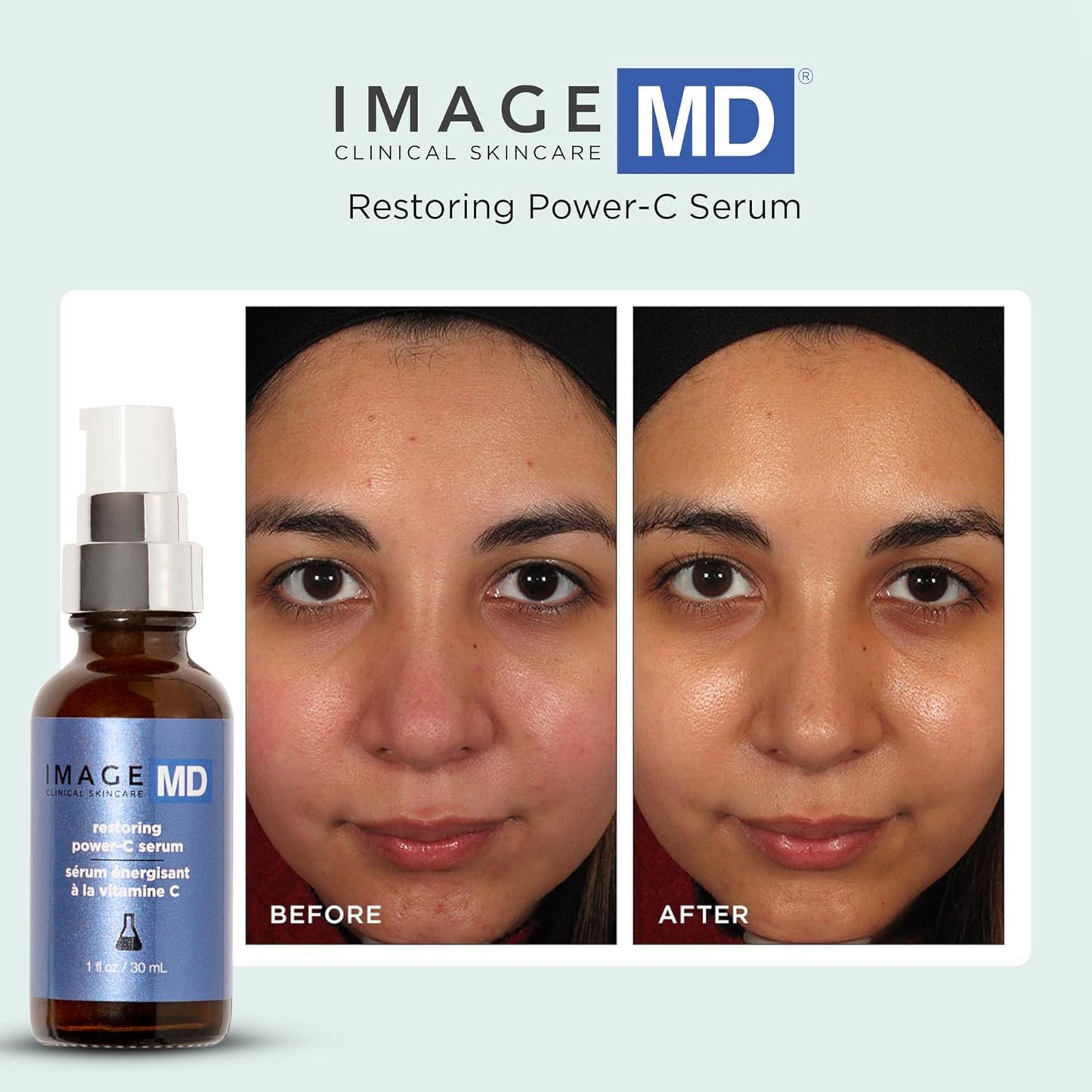 IMAGE Skincare Image MD Restoring Power C Serum Serum Women-1 oz