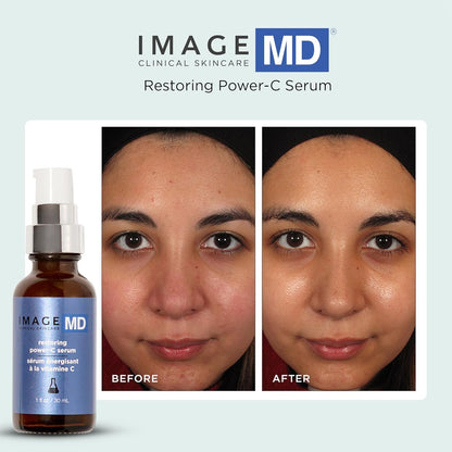 IMAGE Skincare Image MD Restoring Power C Serum Serum Women-1 oz