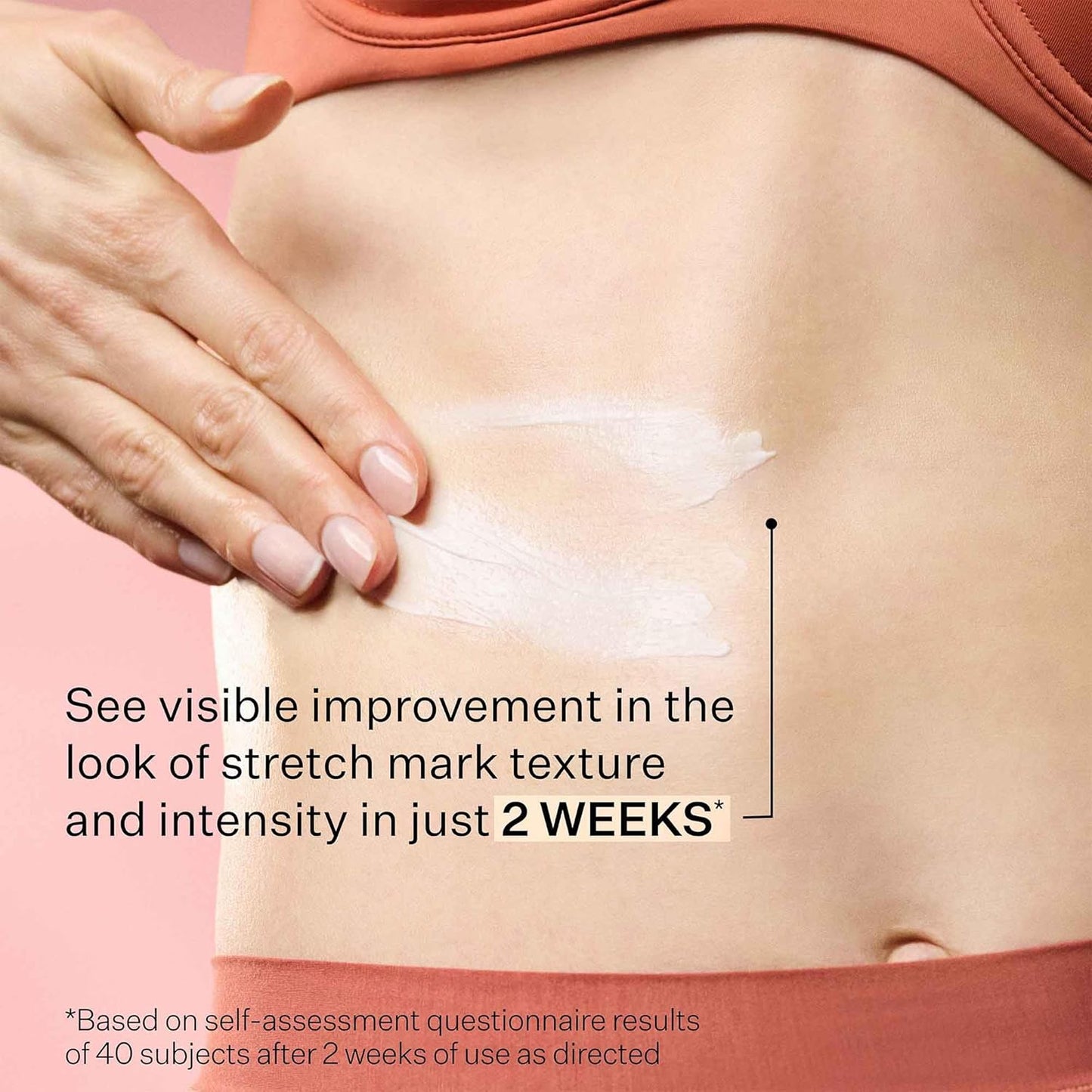 StriVectin SD Advanced™ Plus 強效保濕霜，針對皺紋和妊娠紋，適用於臉部和身體，促進膠原蛋白生成，含勝肽和透明質酸，4 液盎司（1 包）