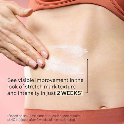 StriVectin SD Advanced™ Plus 強效保濕霜，針對皺紋和妊娠紋，適用於臉部和身體，促進膠原蛋白生成，含勝肽和透明質酸，4 液盎司（1 包）