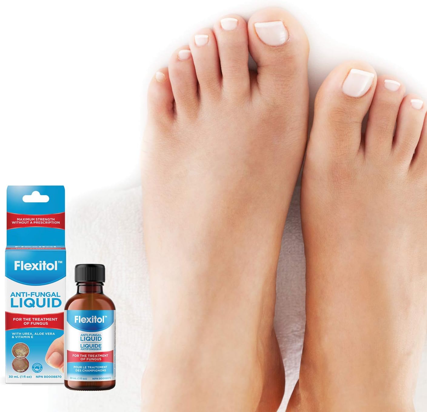 Flexitol 抗真菌液体 - OTC 十一烯酸治疗指甲真菌，有效治疗脚趾甲和手指甲真菌感染（30 毫升）