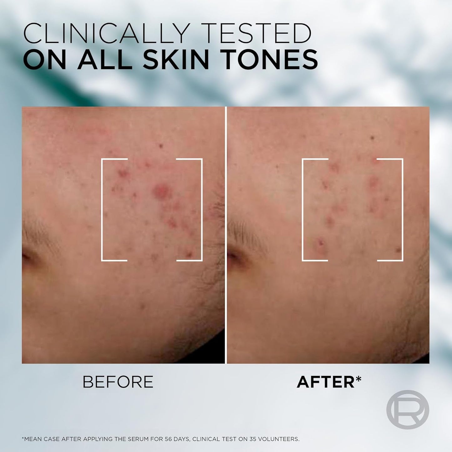 L’Oréal Paris Men Expert Derma Power Moisturizer