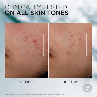 L’Oréal Paris Men Expert Derma Power Moisturizer