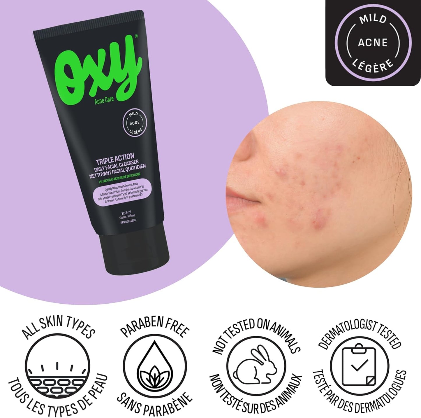 Oxy 三重功效日常洁面乳，经临床验证含有水杨酸 (1.0%) – 适用于轻度痤疮 – 有助于治疗痤疮和预防痤疮爆发 – 不含对羟基苯甲酸酯和防腐剂 – 经皮肤科医生测试