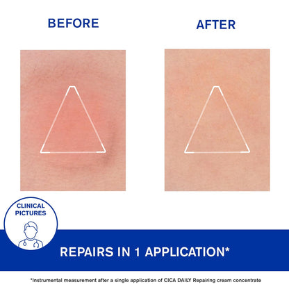 Uriage CICA 每日凝膠霜 - 輕盈乳霜，含玻尿酸、維生素 B5 和銅鋅 - 無香料且不黏膩 - 40ml