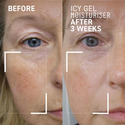 Dr. Brandt iD-STRESS Icy Gel Moisturiser - Revitalize Dull-Looking Skin for a Flawless, Dewy Complexion - 50 g