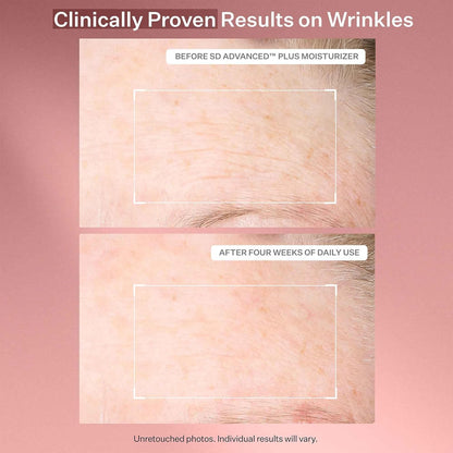 StriVectin SD Advanced™ Plus 強效保濕霜，針對皺紋和妊娠紋，適用於臉部和身體，促進膠原蛋白生成，含勝肽和透明質酸，4 液盎司（1 包）
