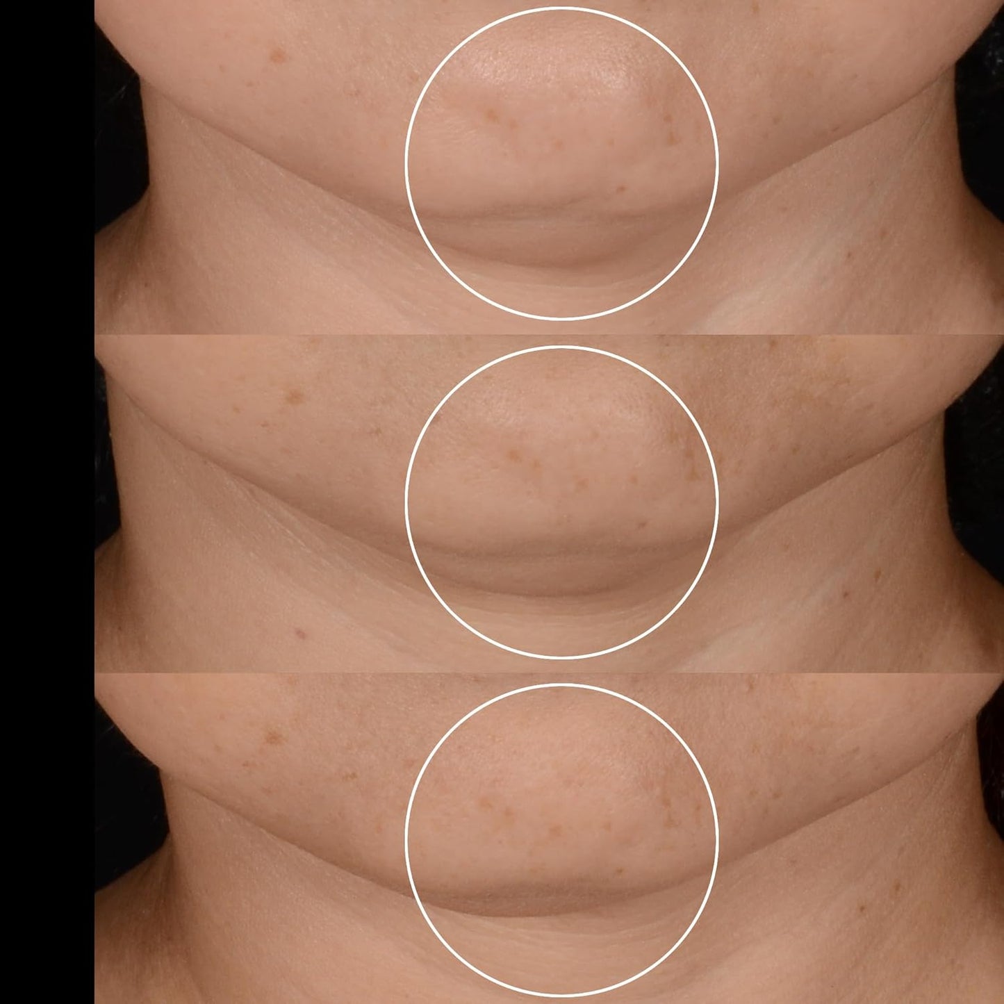 Lancôme Rénergie H.P.N 300-Peptide Face Cream - With Hyaluronic Acid & Niacinamide - Helps Visibly Reduce Lower Face Sagging, Wrinkles, & Dark Spots