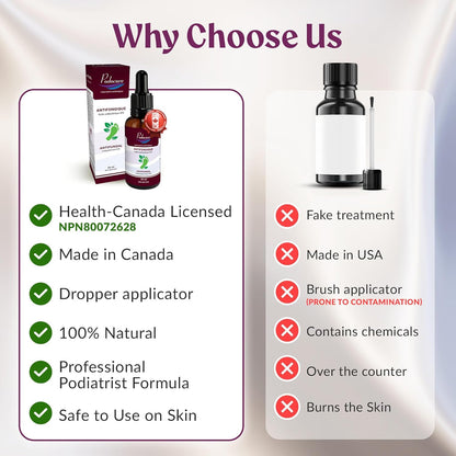 PODOCURE 脚趾甲真菌治疗 - 超强抗真菌液体 30ml，含 25% 十一烯酸 - 脚癣、变色、脱皮、真菌病、发红、瘙痒、异味的天然疗法 - 加拿大制造