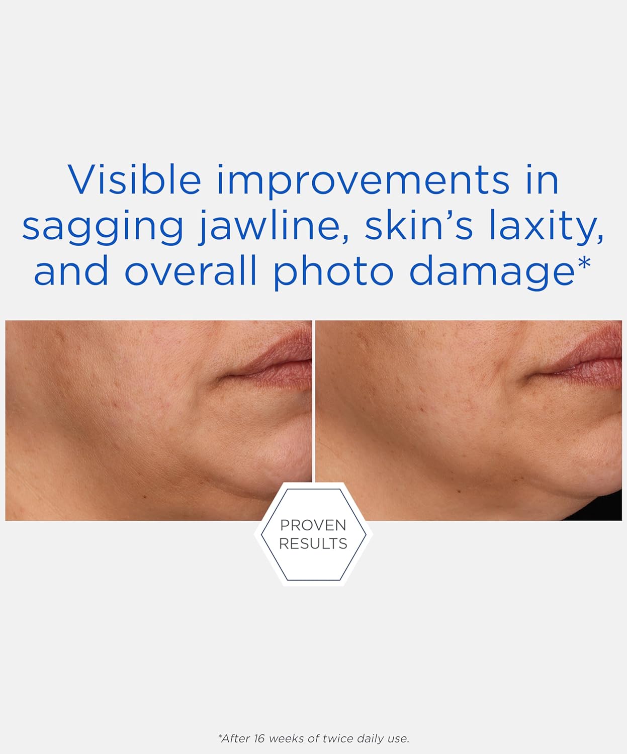 NEOSTRATA Rebound Sculpting Cream, Multi-Action Lifting Moisturizer, With Glycolic Acid, Peptides, and AHA/PHA Blend, Hydrating, Non-comedogenic, 1.7 oz