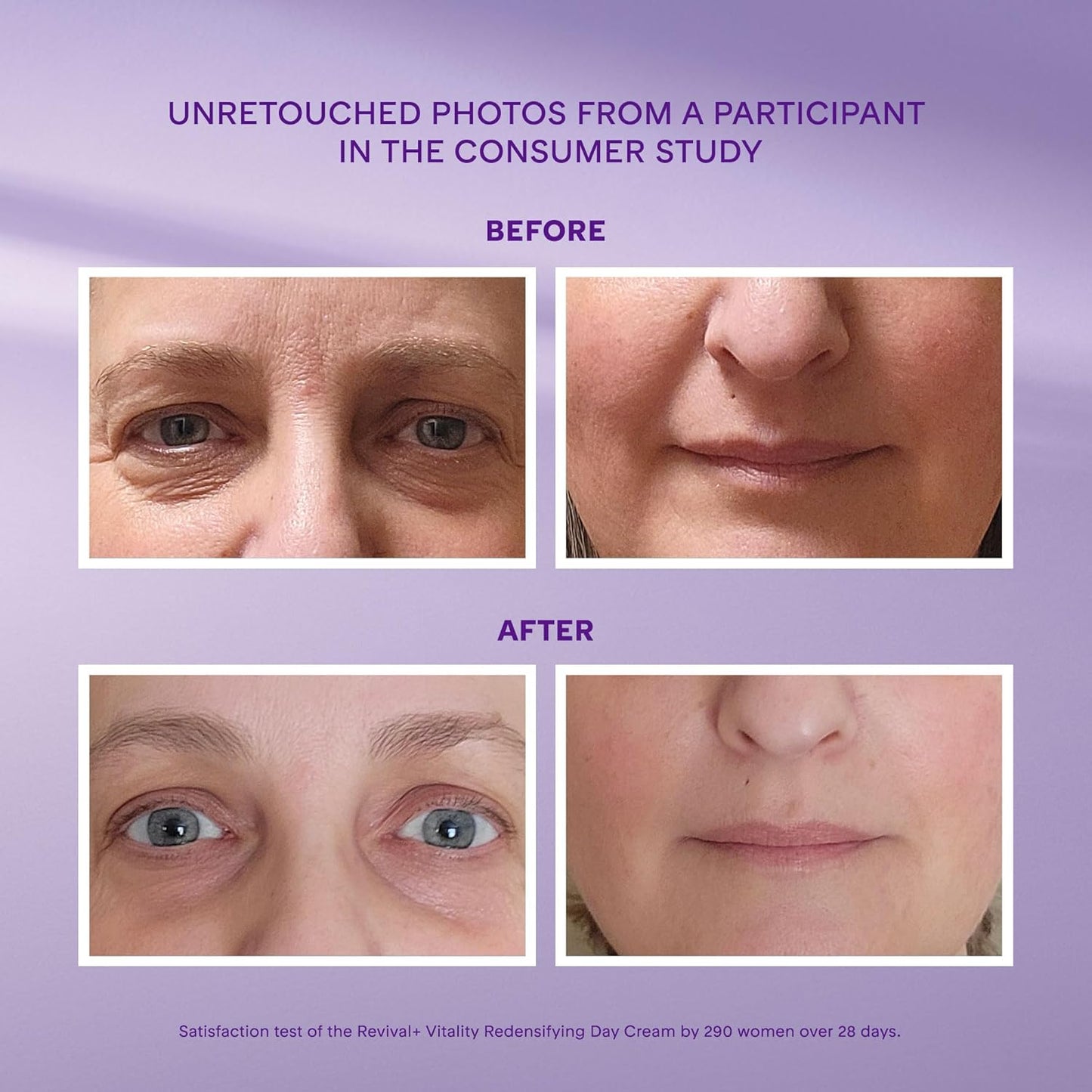 Marcelle Revival+ Vitality Redensifying Day Cream, for Menopausal Skin, with Vitamin D, Hyaluronic Acid and Urea, Hypoallergenic, Fragrance-Free, Paraben-Free, Clean, Cruelty-Free, 50 mL