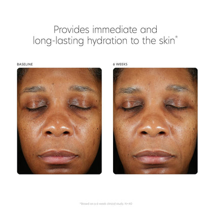 PCA SKIN Hyaluronic Acid Boosting Face Serum (1 fl oz)