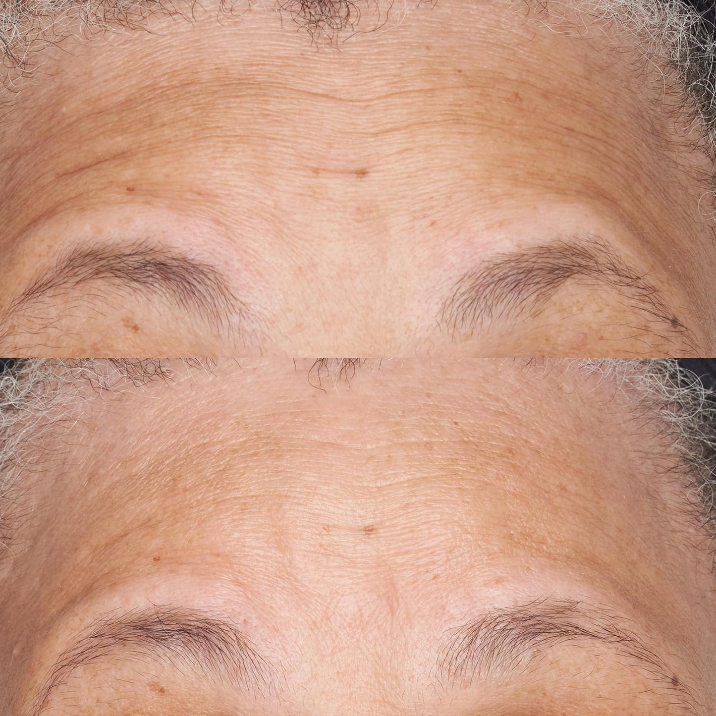 Perricone MD Hypoallergenic Clean Correction Barier Repair Nourishing Moisturizer by Perricone MD for Unisex - 2 oz Moisturizer