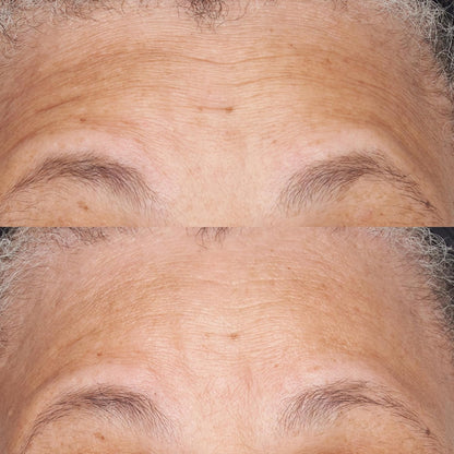 Perricone MD Hypoallergenic Clean Correction Barier Repair Nourishing Moisturizer by Perricone MD for Unisex - 2 oz Moisturizer