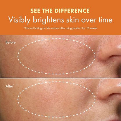 Origins GinZing Radiance-Boosting Gel Moisturizer | For All-Day Glow | With Vitamin C & Niacinamide