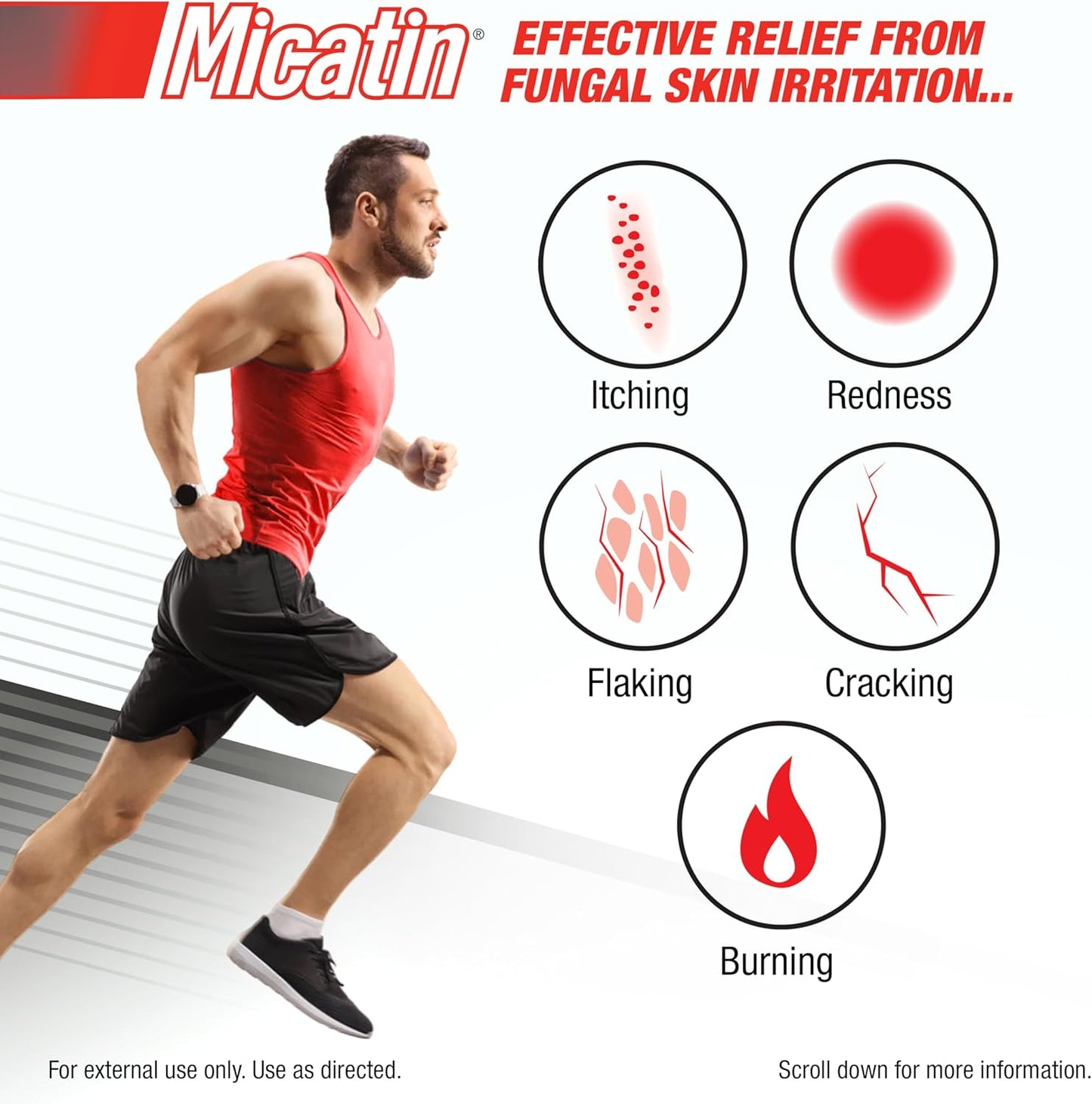 米卡汀乳膏，用于治疗足癣、股癣和癣，具有抗真菌和抗菌作用