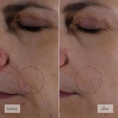 PHILOSOPHY hope in a jar trial set 3 pieces: smooth-glow moisturizer 15ml + eye revival serum in cream 3ml + biome-balance glow serum 3ml