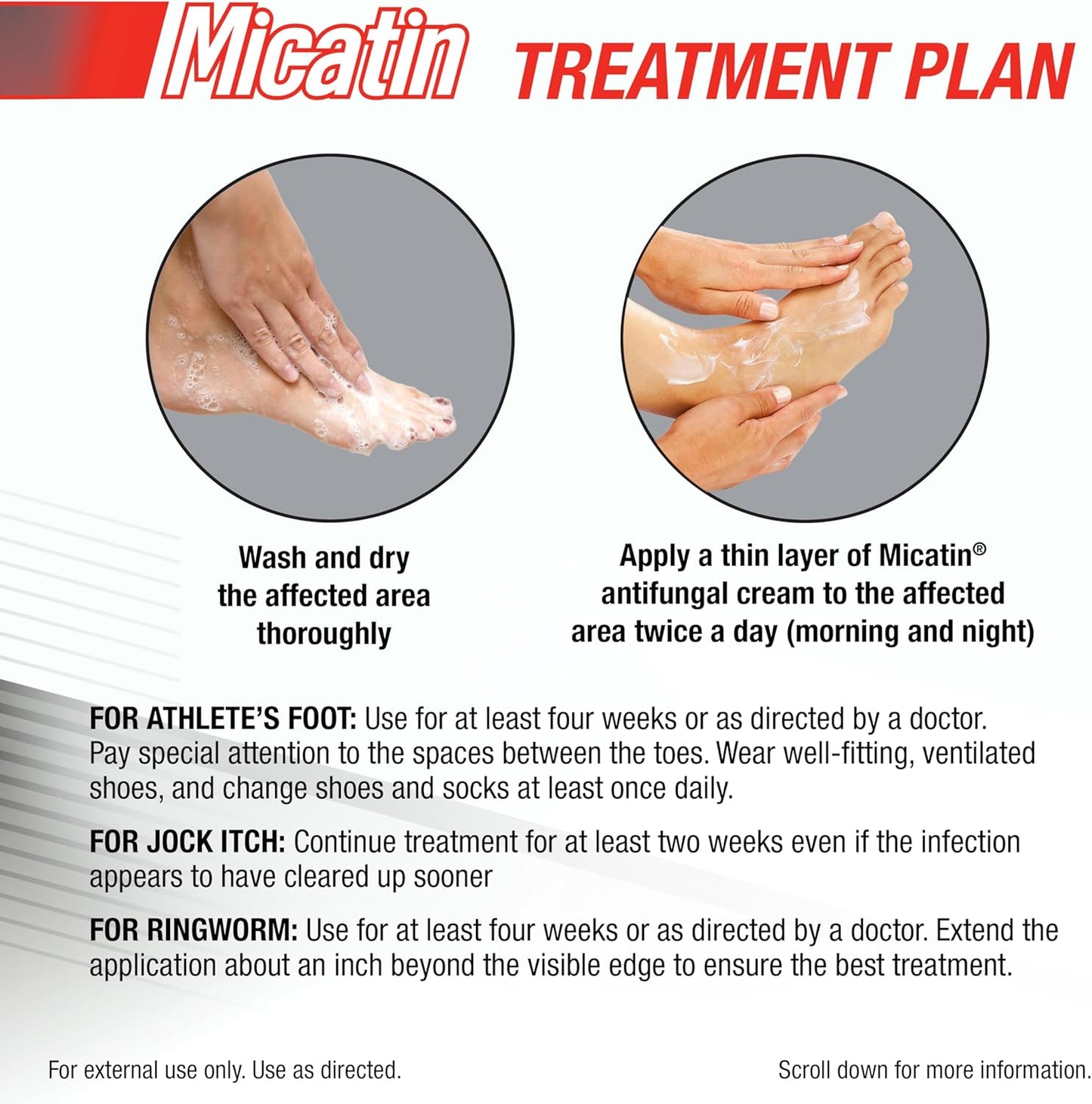 米卡汀乳膏，用于治疗足癣、股癣和癣，具有抗真菌和抗菌作用