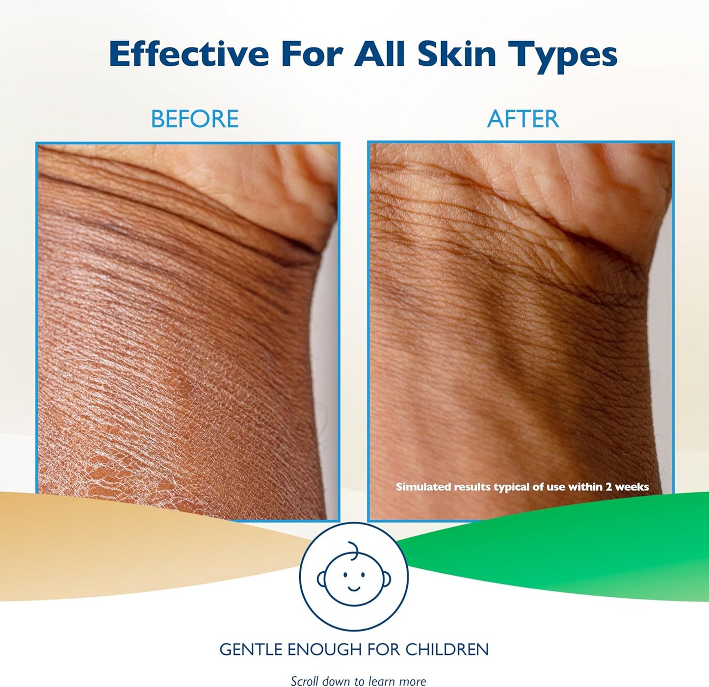 Glaxal Base 保湿霜，缓解瘙痒、干燥皮肤和湿疹，含舒缓燕麦和芦荟，低过敏性，不含防腐剂，含燕麦和芦荟，加拿大制造，227 克