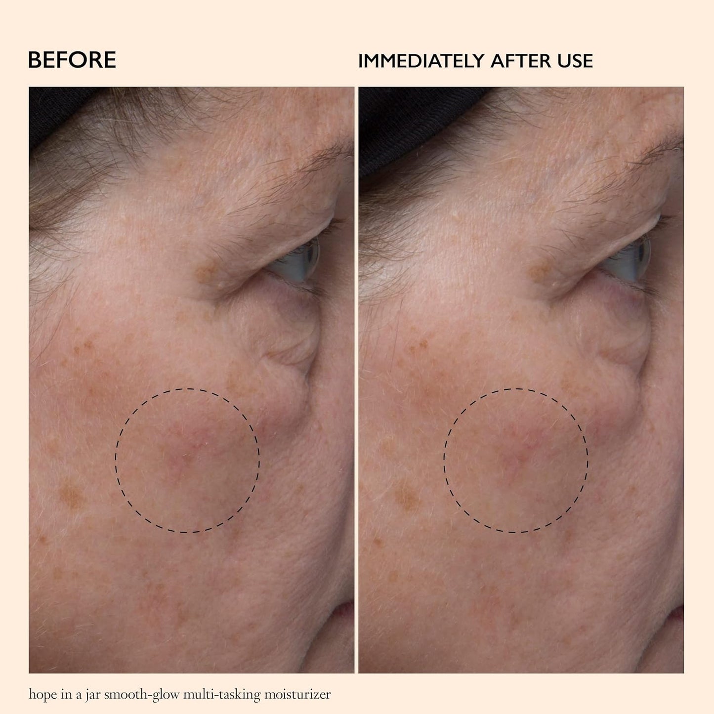 PHILOSOPHY hope in a jar smooth-glow moisturizer 60ml, multi-tasking moisturizer with pro-vitamin p, glycolic & hyaluronic acids