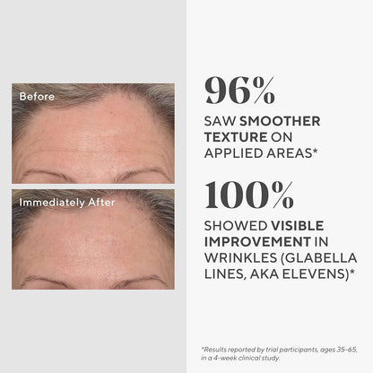 Murad 標靶抗皺霜 - 再生抗皺乳霜 - 即時填充抗皺霜 - 溫和抗老保濕透明質酸護理，經科學驗證，15ml