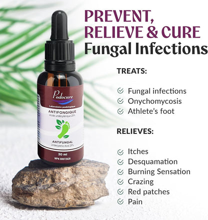 PODOCURE 脚趾甲真菌治疗 - 超强抗真菌液体 30ml，含 25% 十一烯酸 - 脚癣、变色、脱皮、真菌病、发红、瘙痒、异味的天然疗法 - 加拿大制造