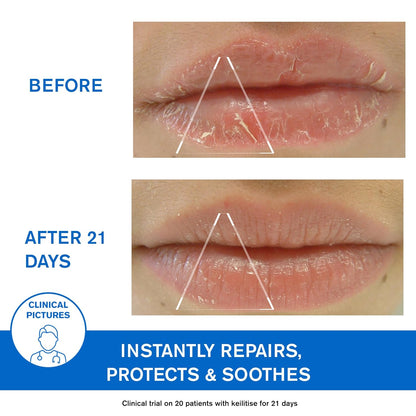 Uriage Bariéderm-CICA Lips Repairing Balm - Repairs, Insulates and Immediately Soothes Dry Chapped & Damaged Lips - With Glycerin - Long-Lasting Formula & Fragrance-Free - 15ml