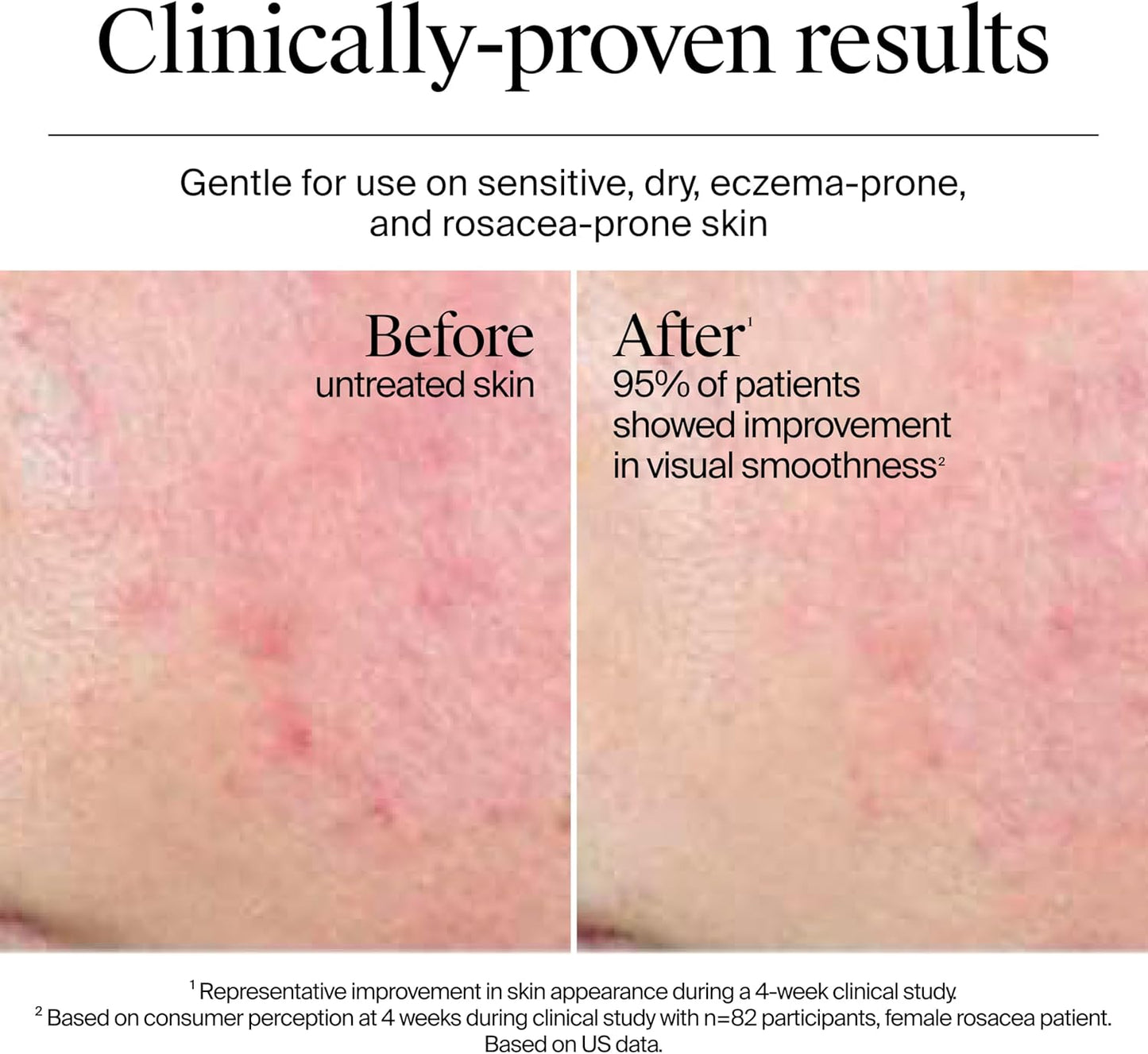 Neutrogena Fragrance Free Hydro Boost Gel Cream for Extra Dry Skin, Hyaluronic Acid Face Moisturizer for Extra-Dry Skin, Sensitive & Acne-Prone Skin Provides Long Lasting Hydration, Non-Comedogenic, 50ml